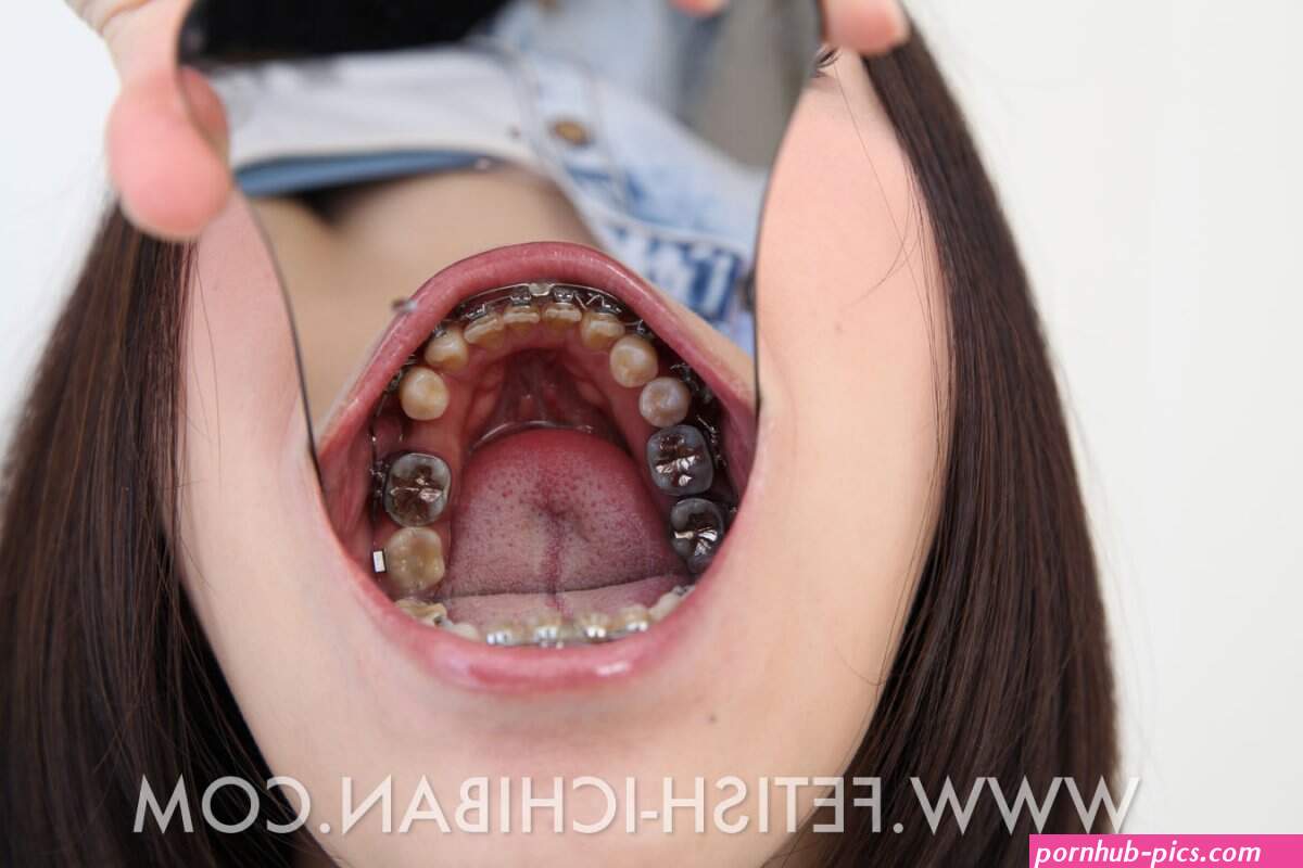 japanese porn braces