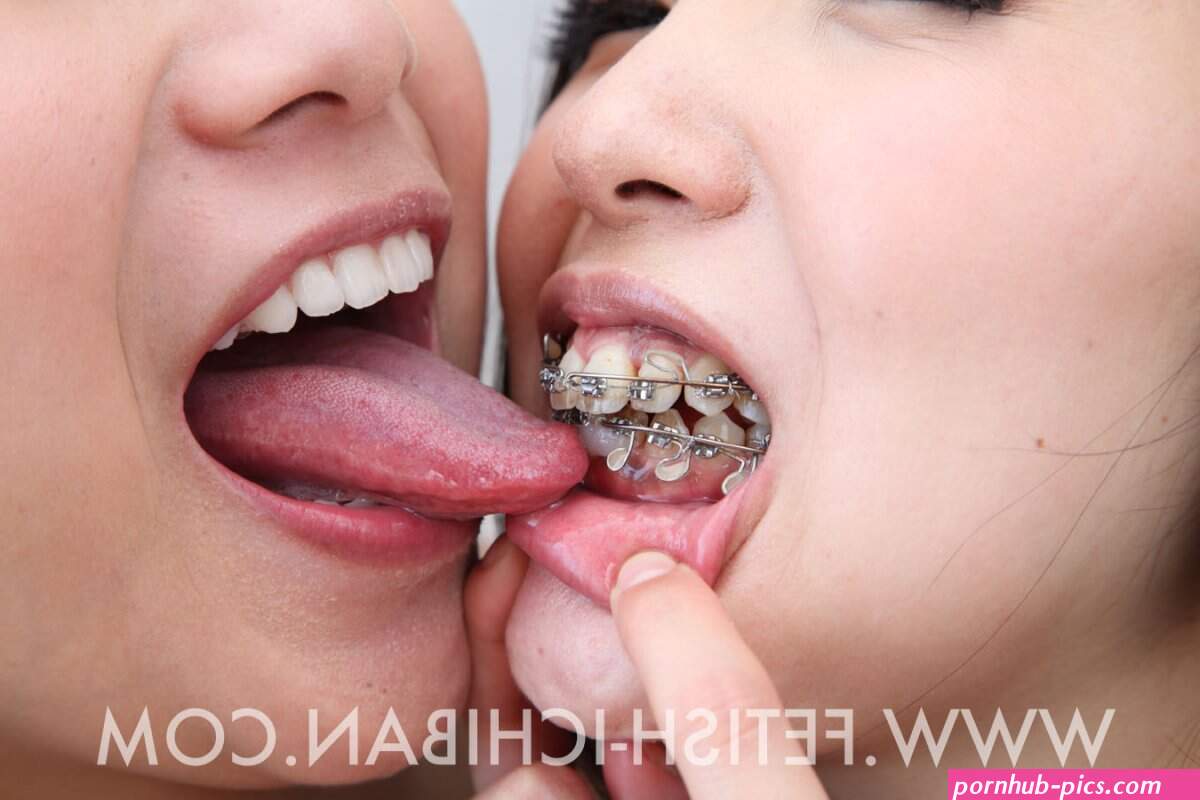 japanese porn braces