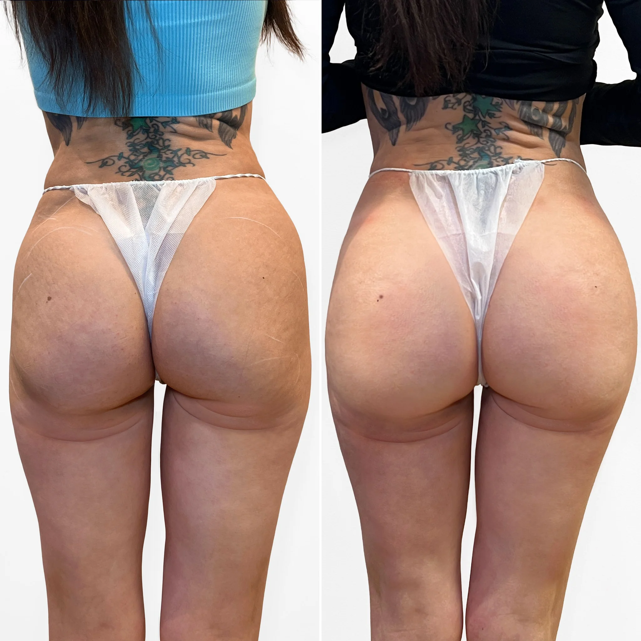 onion booty thong dse