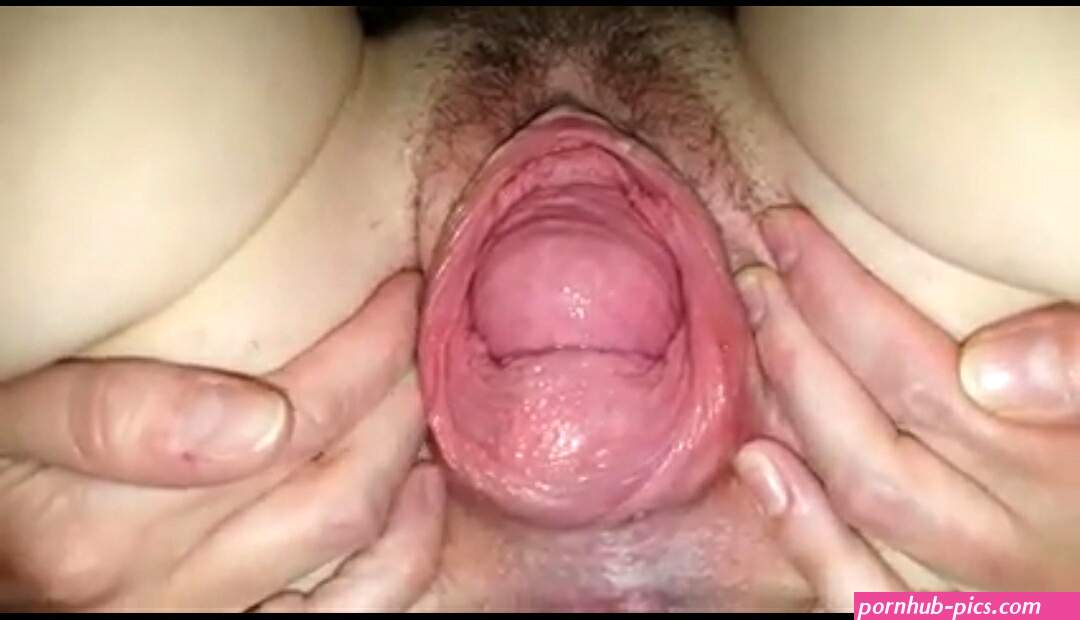 pussyprolapse