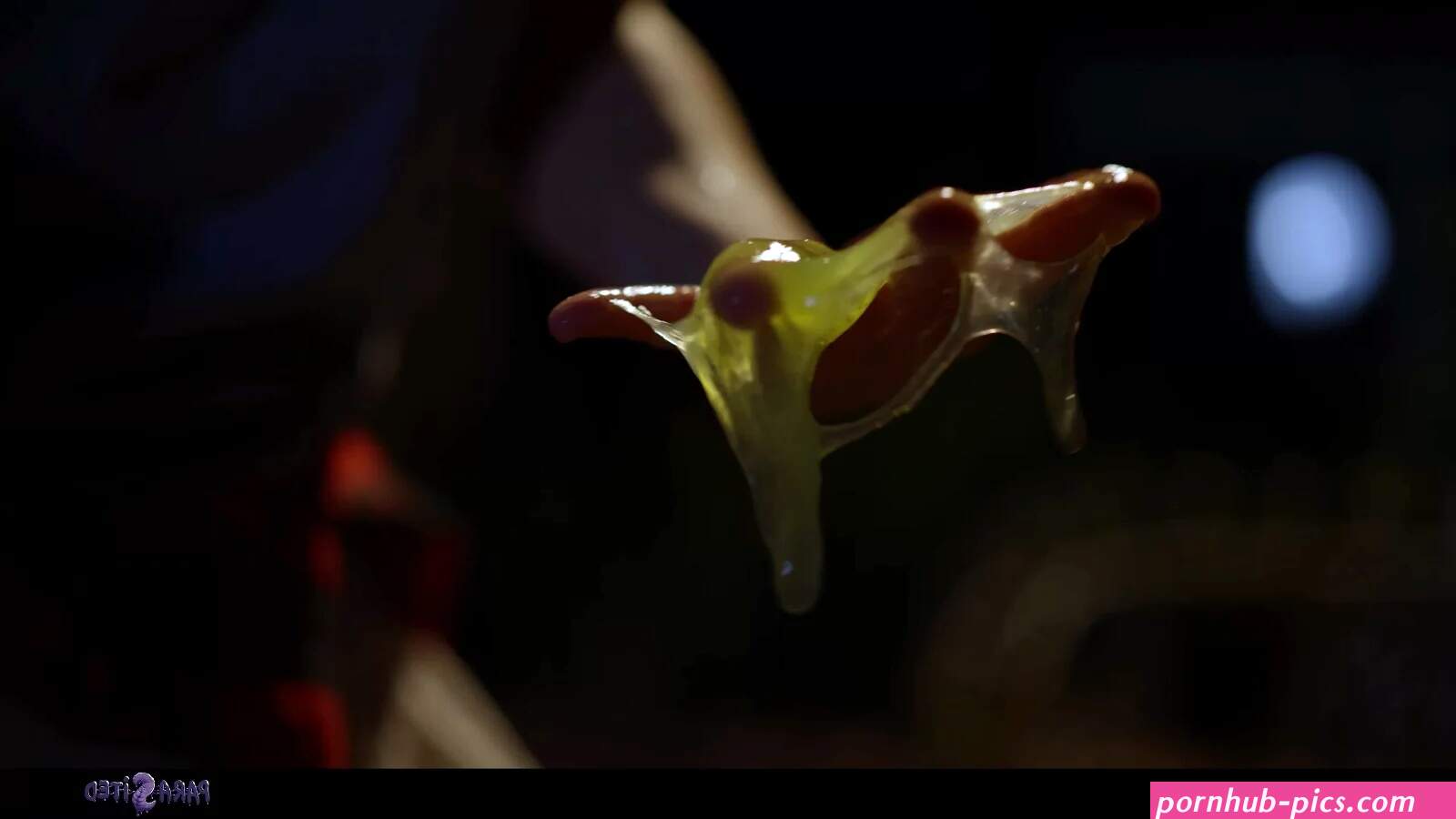 Infection