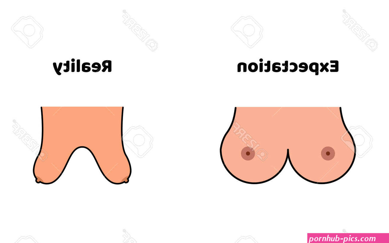 Expectation And Reality Of Women Boobs. Beautiful And Ugly Breast. Vector Royalty Free SVG, Cliparts, Vectors, and Stock Illustration. Image 159765614.
