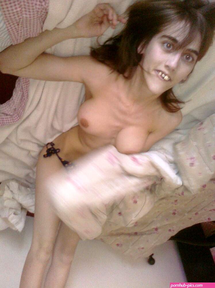 retard nude thread?