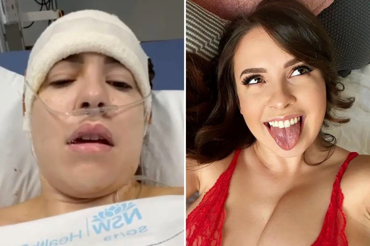 OnlyFans model has brain surgery kept taking nudes in hospital