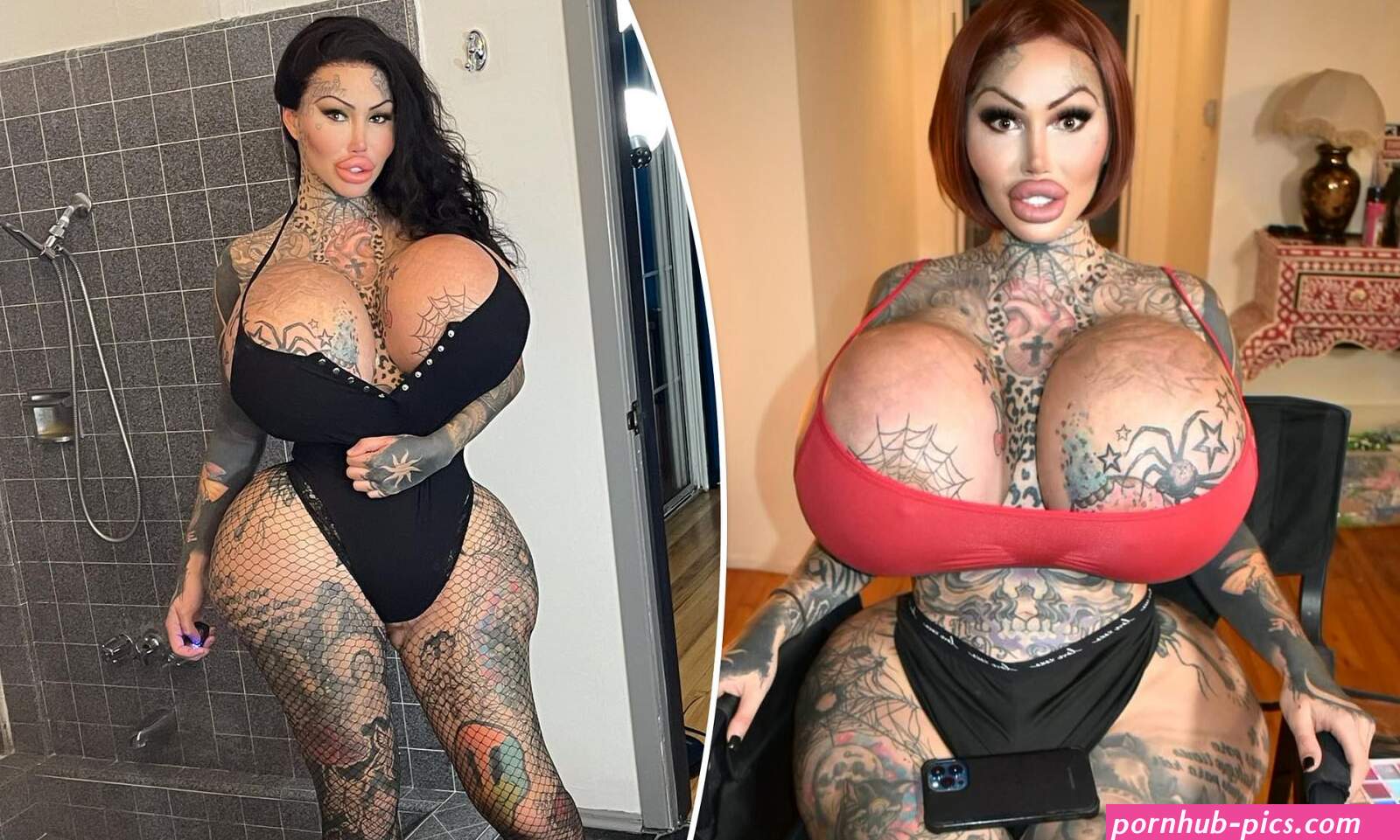 Surgery-addicted social media star may need wheelchair for rest of her life