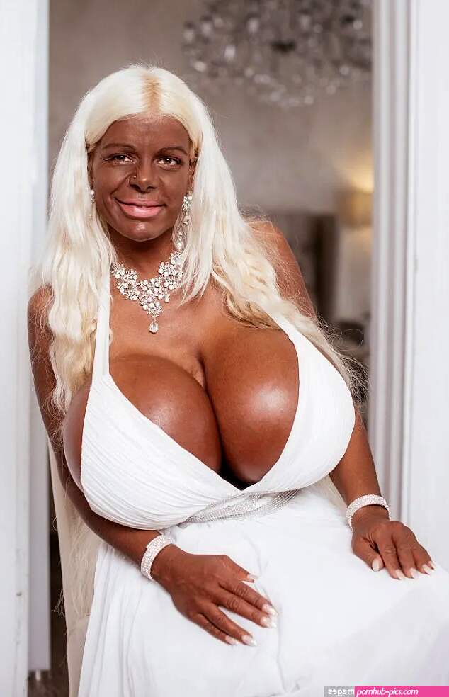 Worlds Largest Biggest Macromastia Boobs