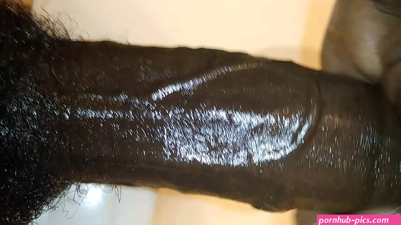 Dick Veins