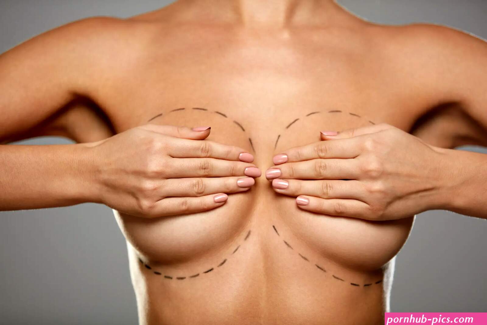 Non-Surgical Breast Lift