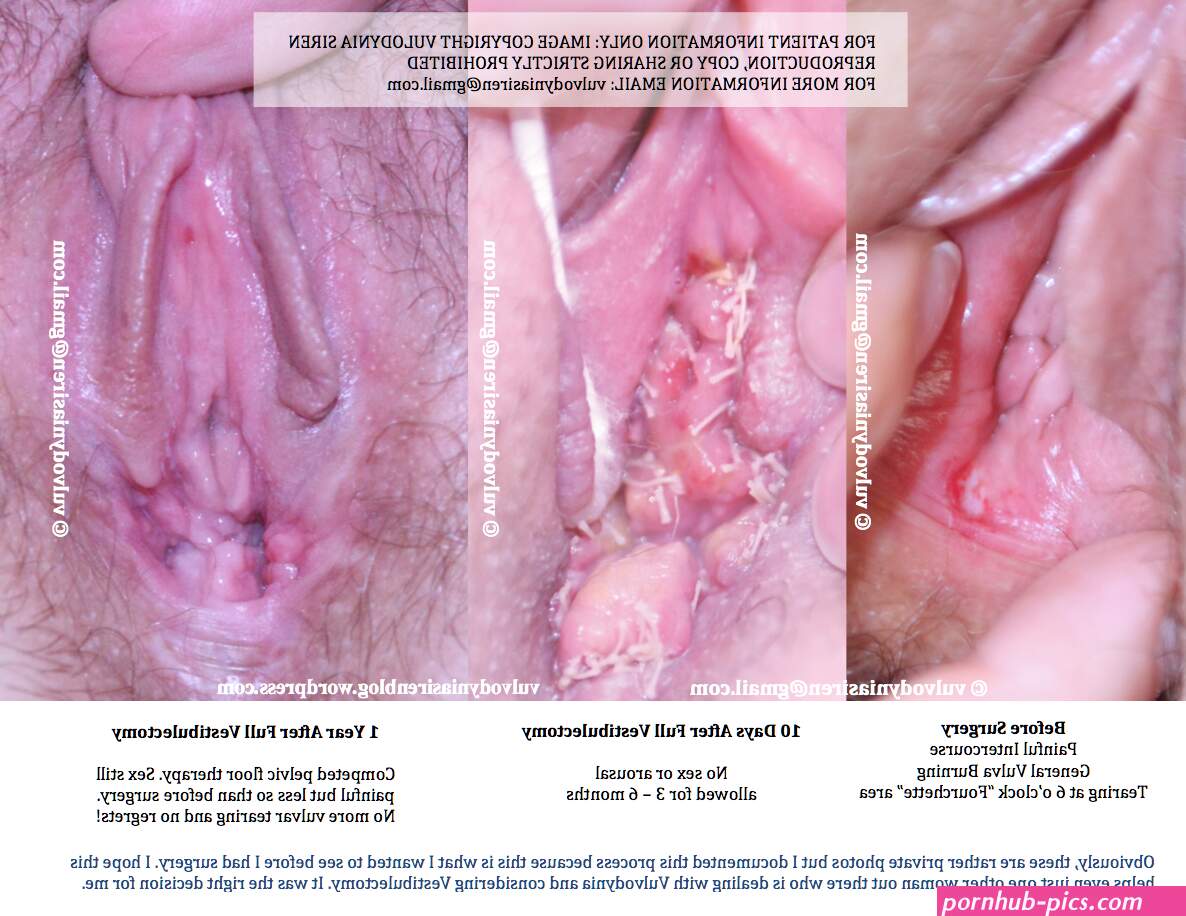 Aroused vagina vs normal vagina. Naked Images.