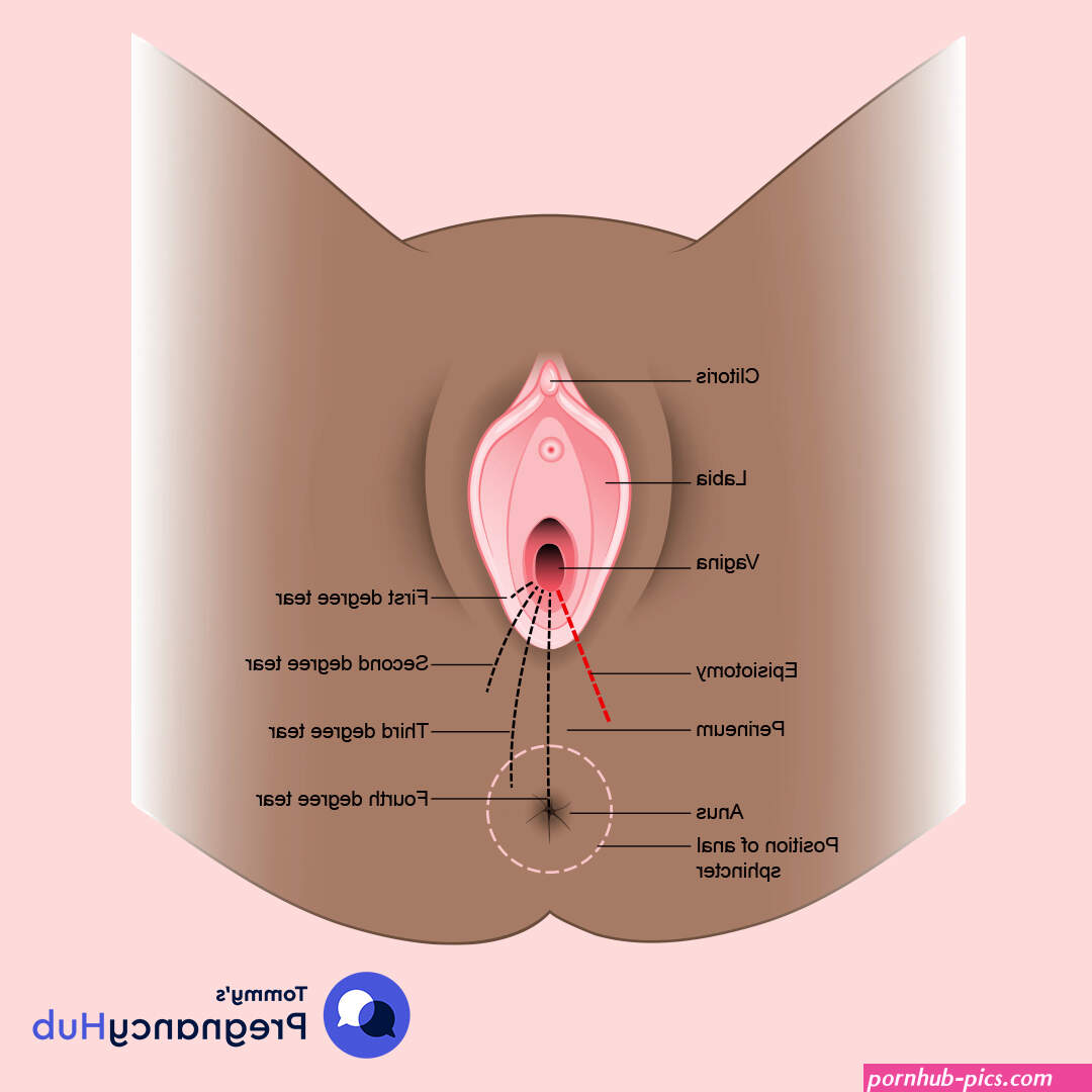 Perineal tears