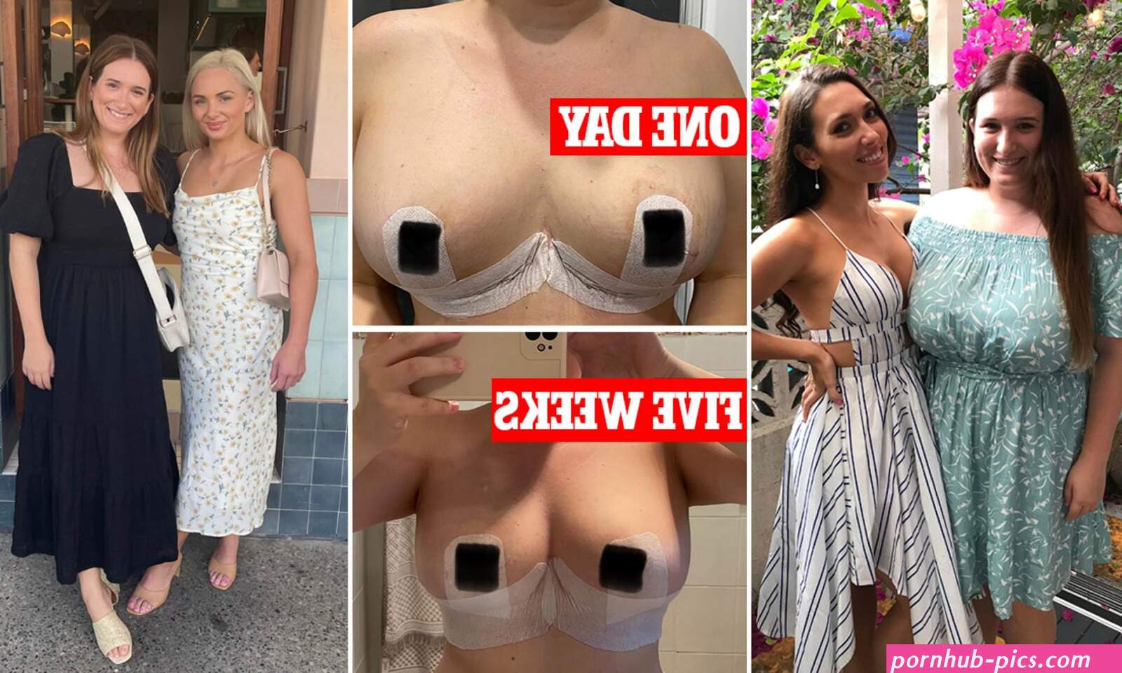 Nurse 27 who was embarrassed by her 16H cup chest gets life-changing reduction