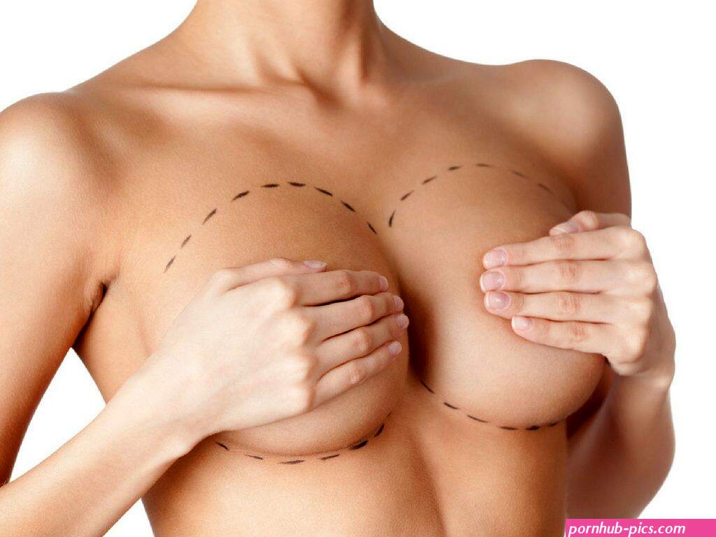 The Perfect Breast Augmentation