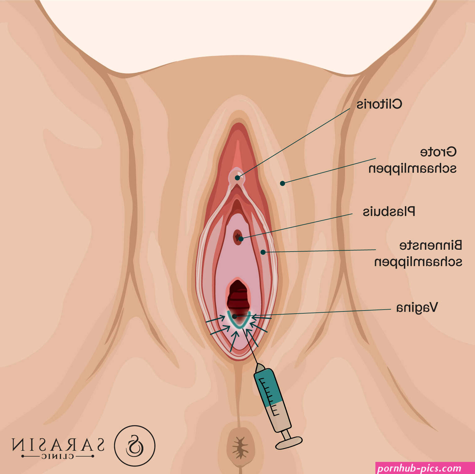 Choose your Vaginal Health treatment at Sarasin Clinic
