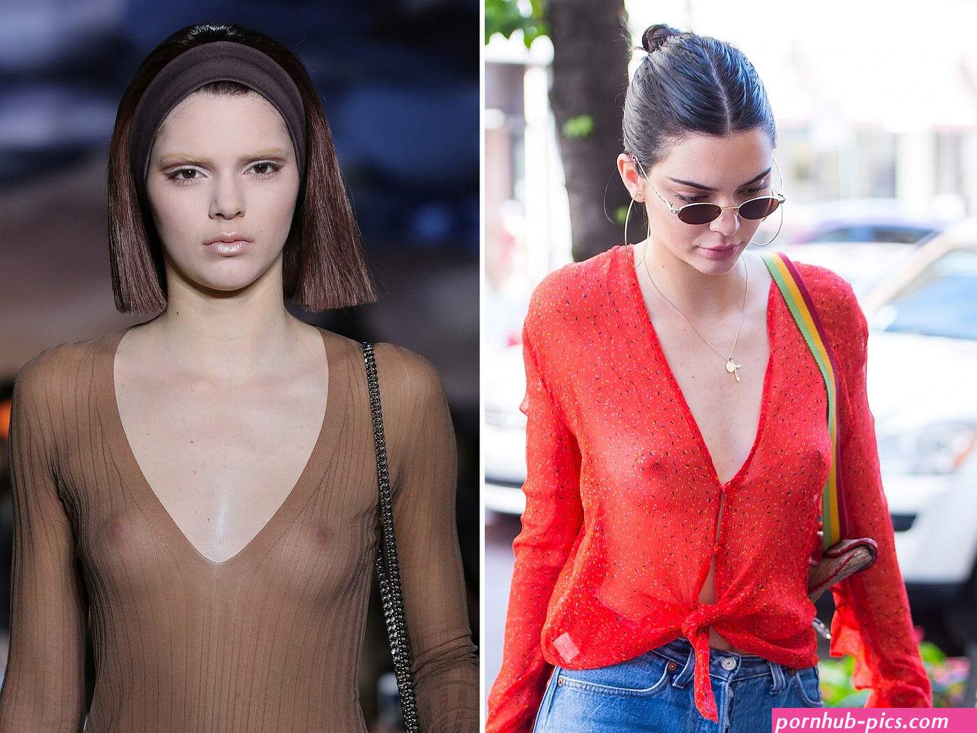 Kendall Jenner and the Vanishing Vulva
