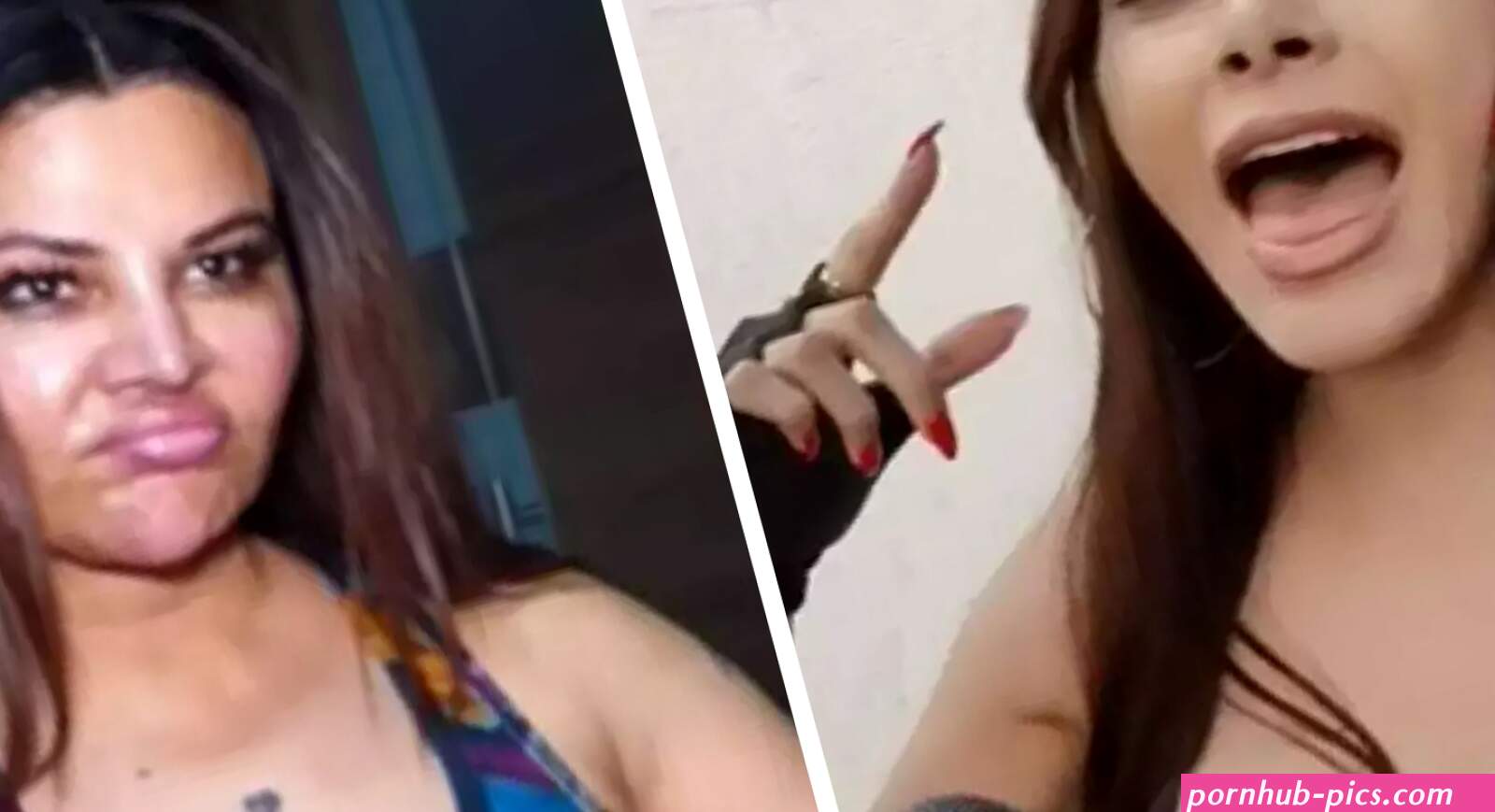 penis