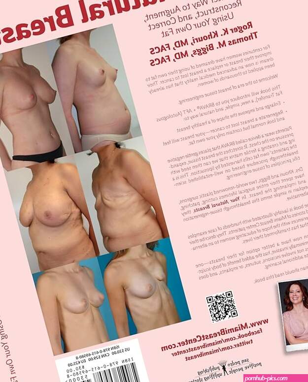 Your Natural Breasts: A Better Way to Augment Reconstruct and Correct Using Your Own Fat: Roger K. Khouri Thomas M. Biggs Patricia San Pedro Managing Editor Lorraine Fico-White Copyeditor Erik Gonzalez: 9780615695808: