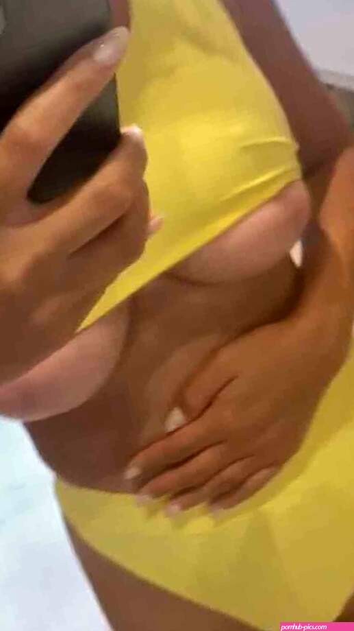John Legends Wife Chrissy Teigen Shares A Picture From The Operation Table Before She Got Breast Implants Removed Asks Fans To Trust Her-Pic INSIDE