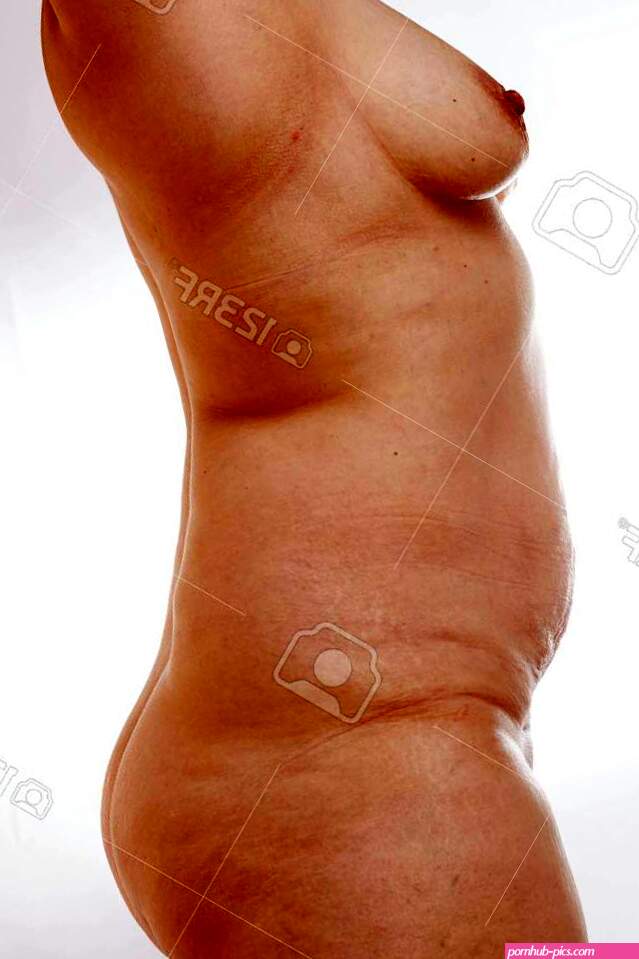 Naked 40-year-old Woman With Sagging Breasts Overweight Stretch Marks And Cellulite On A White Isolated Background. Concept For Medicine And Cosmetology Stock Photo Picture and Royalty Free Image. Image 146104173.