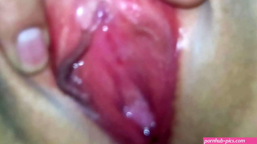 B ln gi 1 con