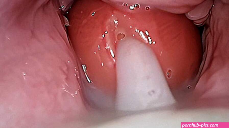 Cum Compilation Camera in Vagina and Anus Cum on Cervix