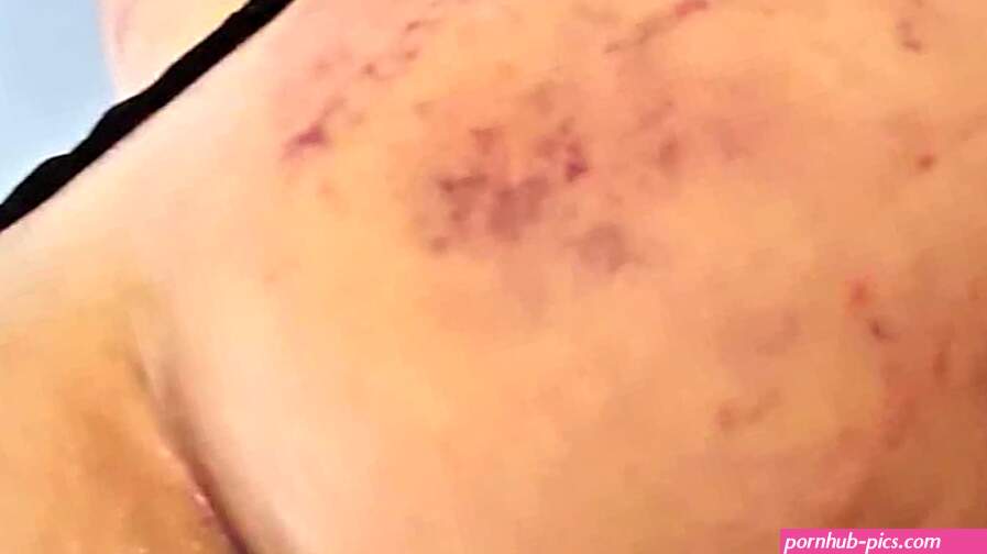 Hard Fucking my marked ass aftermath of a BDSM festival