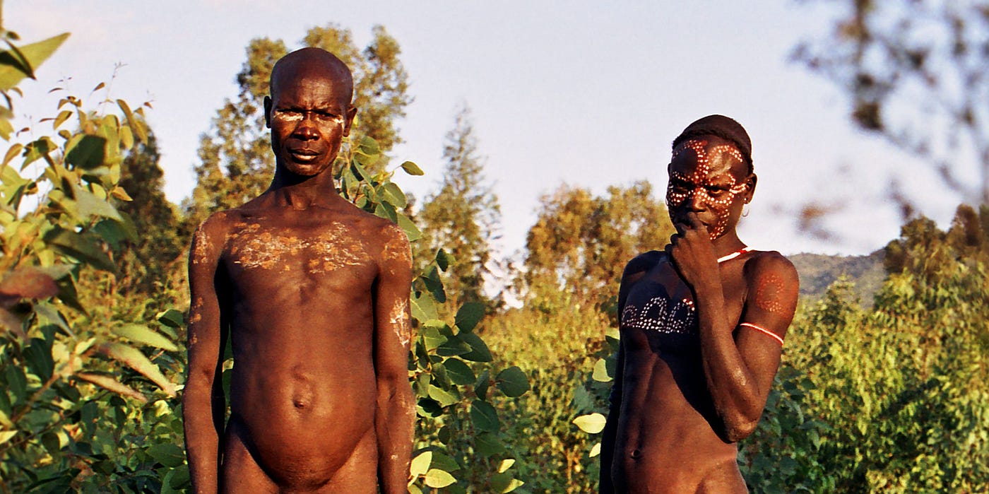 Circumcision Among Onlookers and Juggling with Happiness in full Nudity