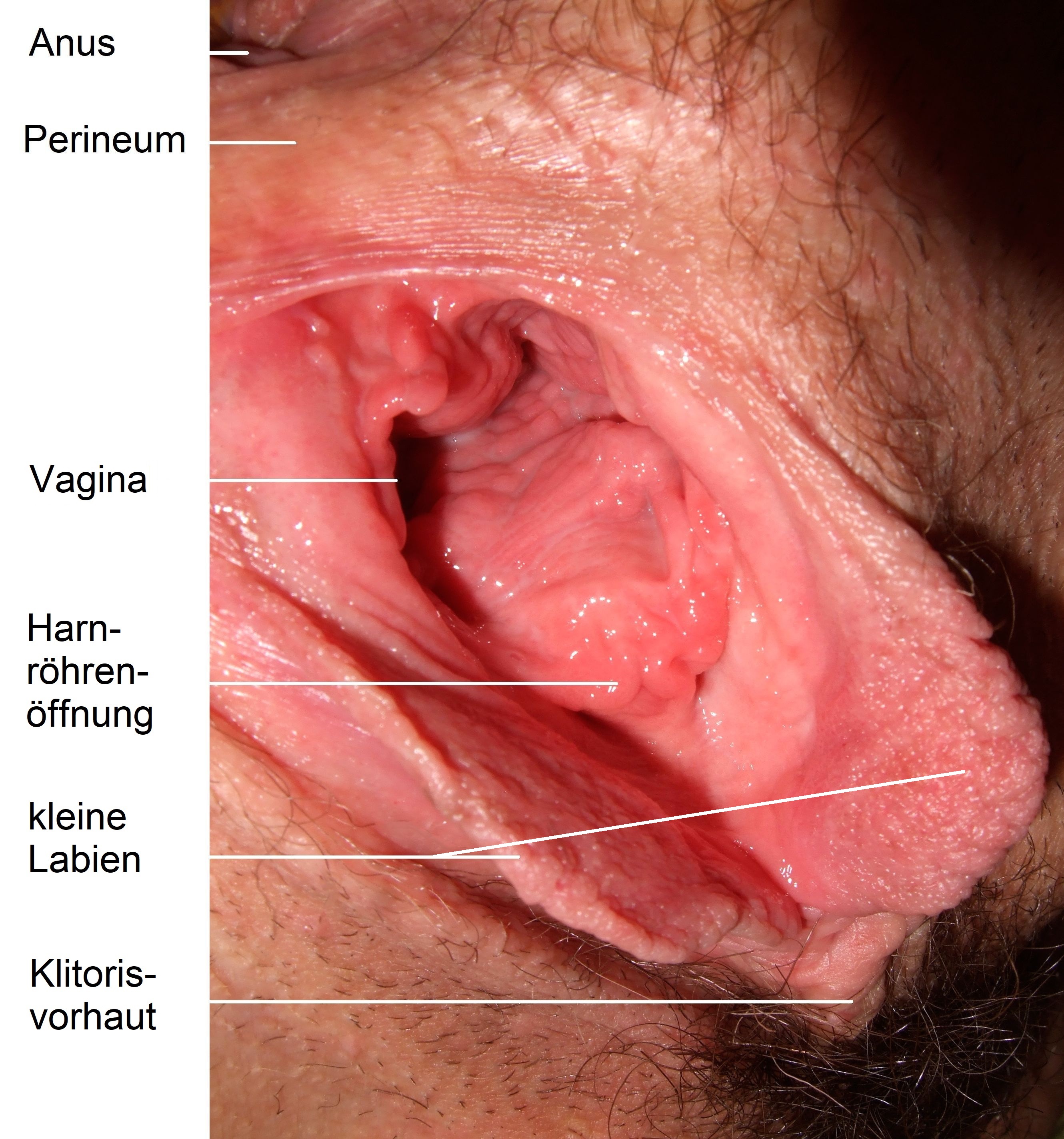 File:Inside vagina 1 de.jpg