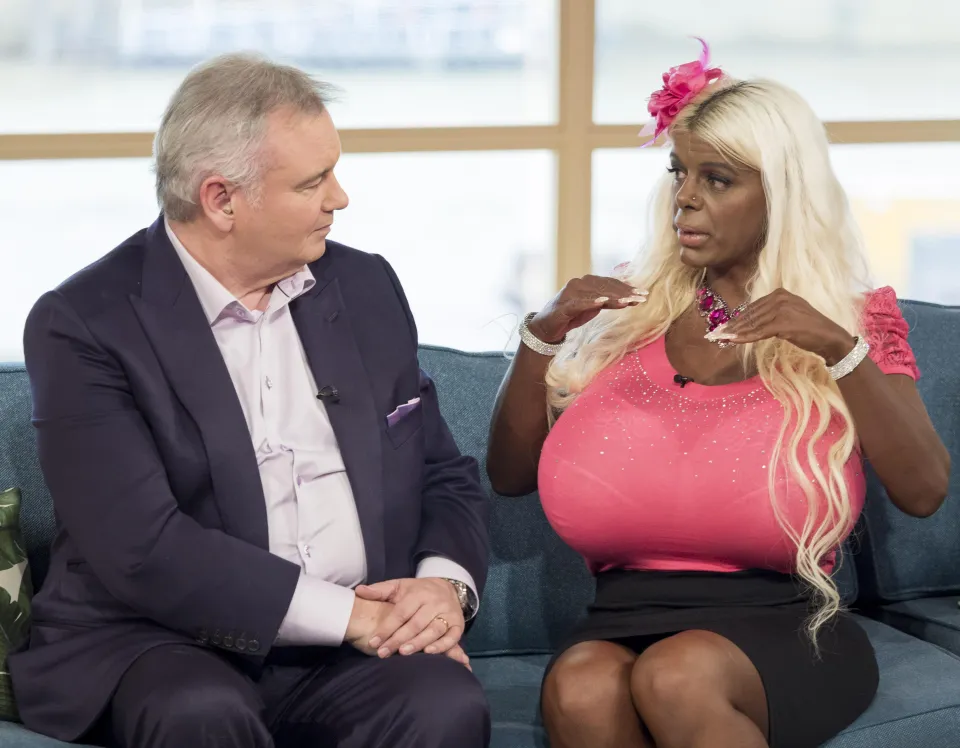 Who is Martina Big? Woman with 32S boobs was born white but used tanning injections and now identifies as black