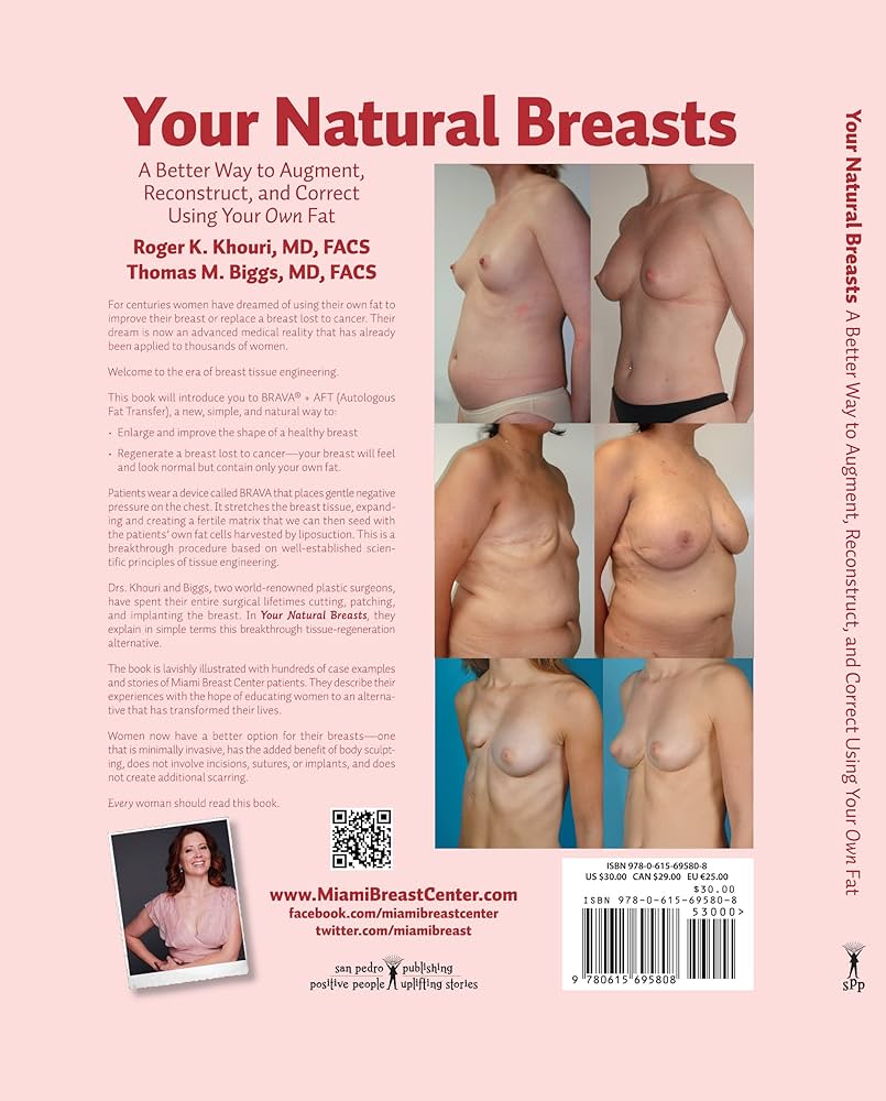 Your Natural Breasts: A Better Way to Augment Reconstruct and Correct Using Your Own Fat : Roger K. Khouri Thomas M. Biggs Patricia San Pedro Managing Editor Lorraine Fico-White Copyeditor Erik Gonzalez:
