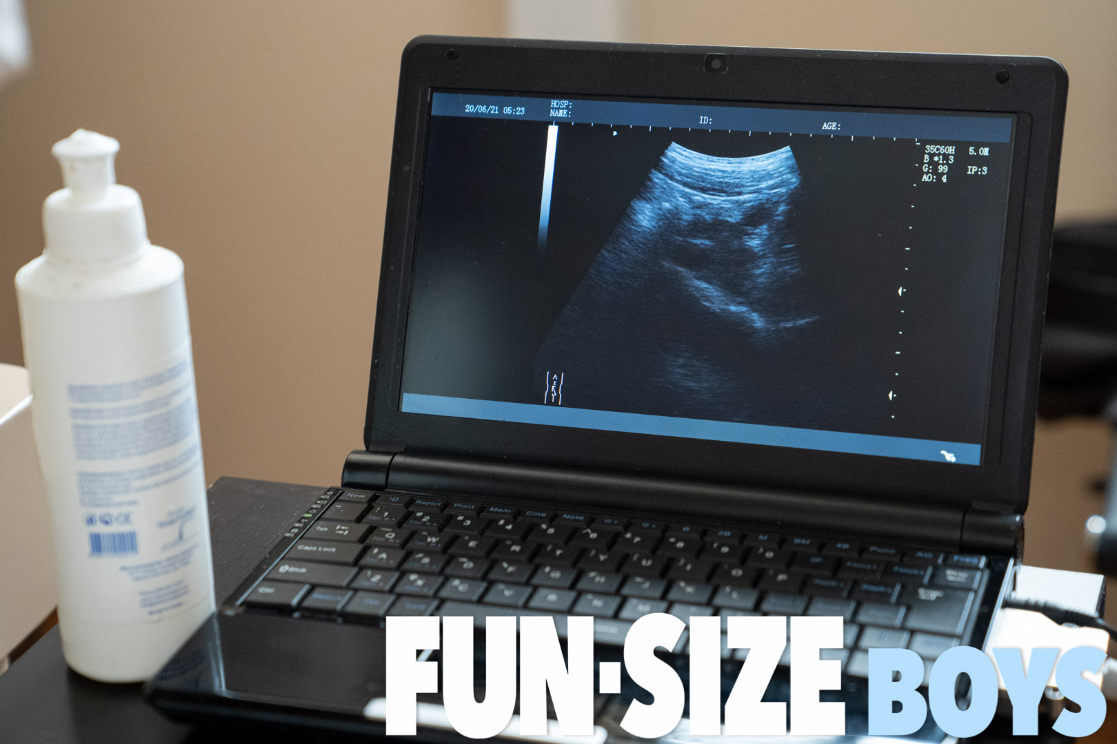 Anal X-ray Vision Lucas Dr. Wolf Fun Size Boys