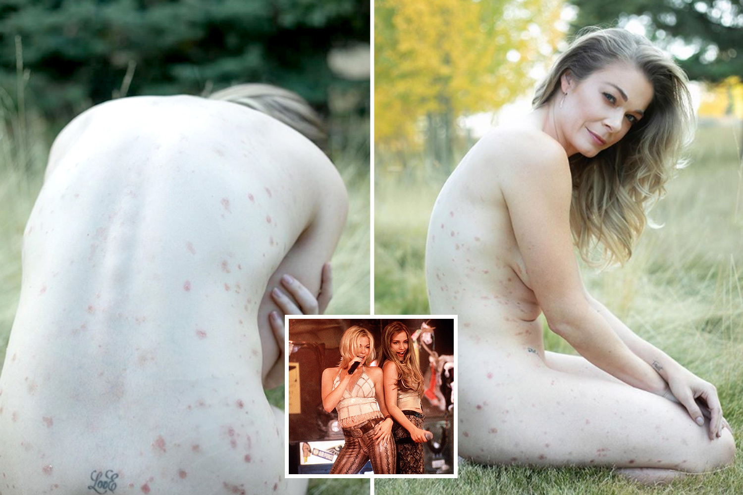 Leann Rimes poses completely naked as she unabashedly shows off her psoriasis as she says I needed to do this