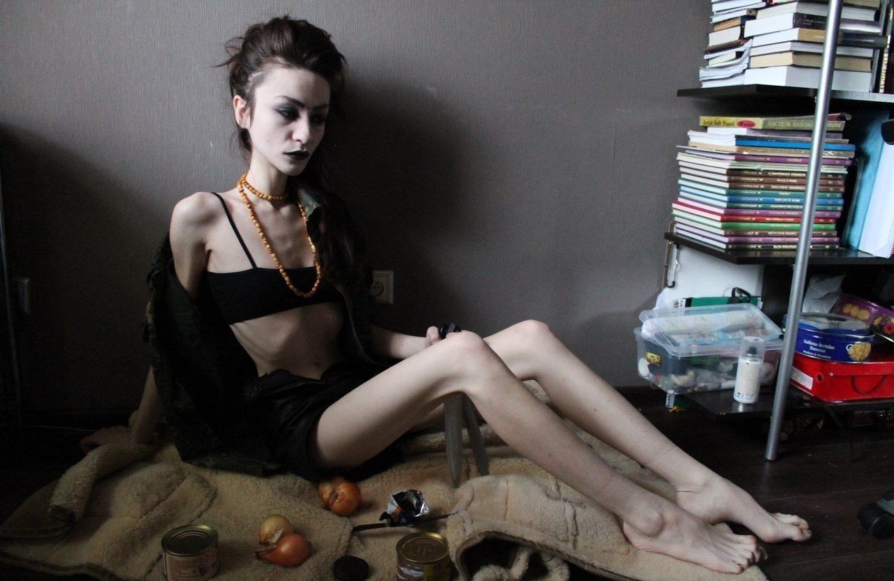 Anorexic woman
