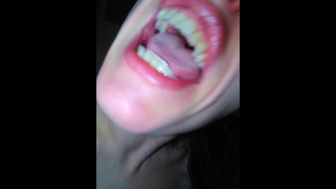 You Said You Couldnt Take My Kindness Freestyle Ugly Girl Fucked up Teeth Singing Onlyfans Whore OF
