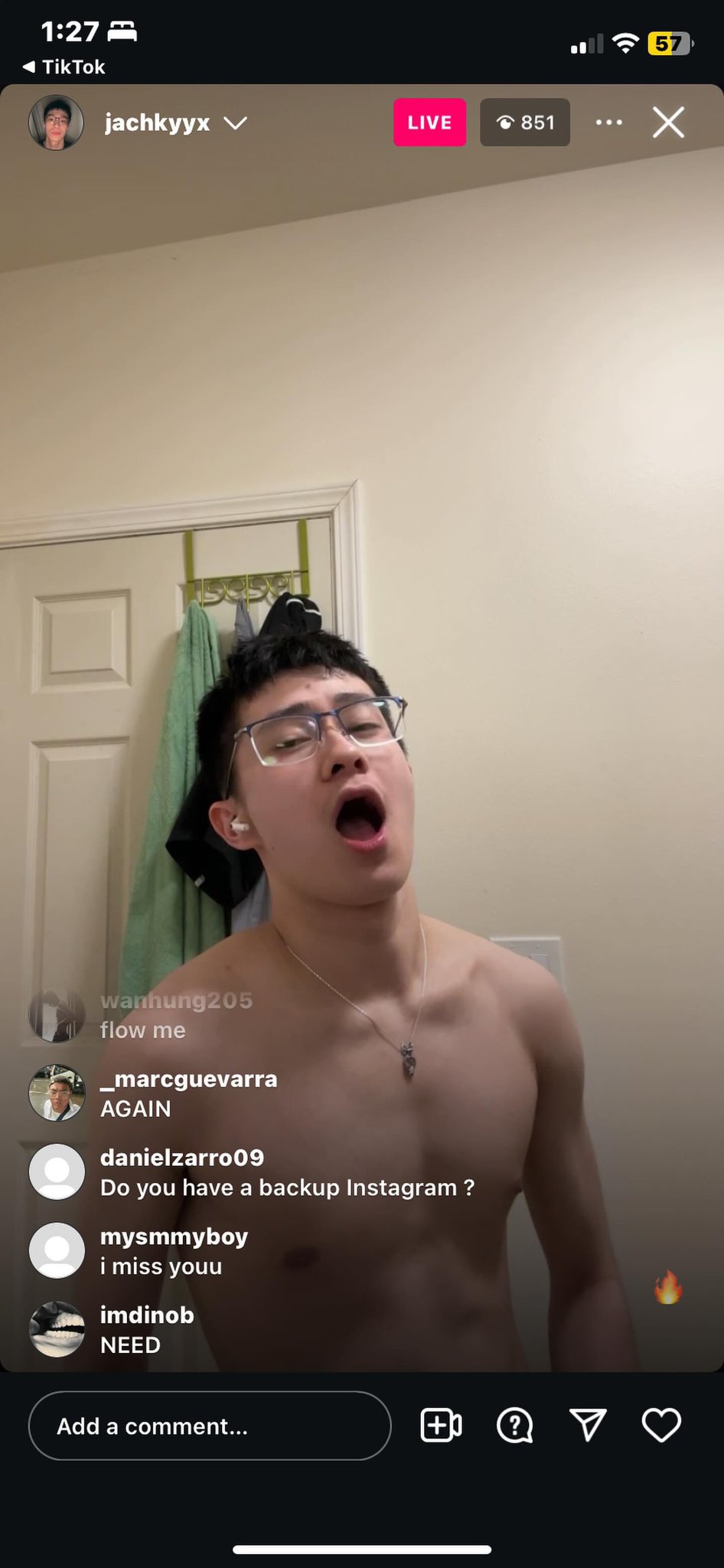 Axetyn Xander AxetynX X