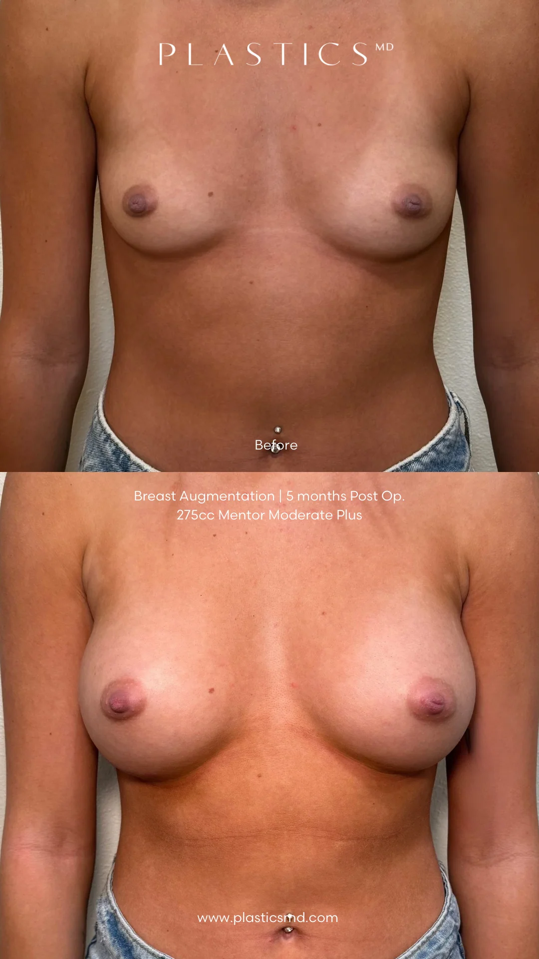 the naked breast