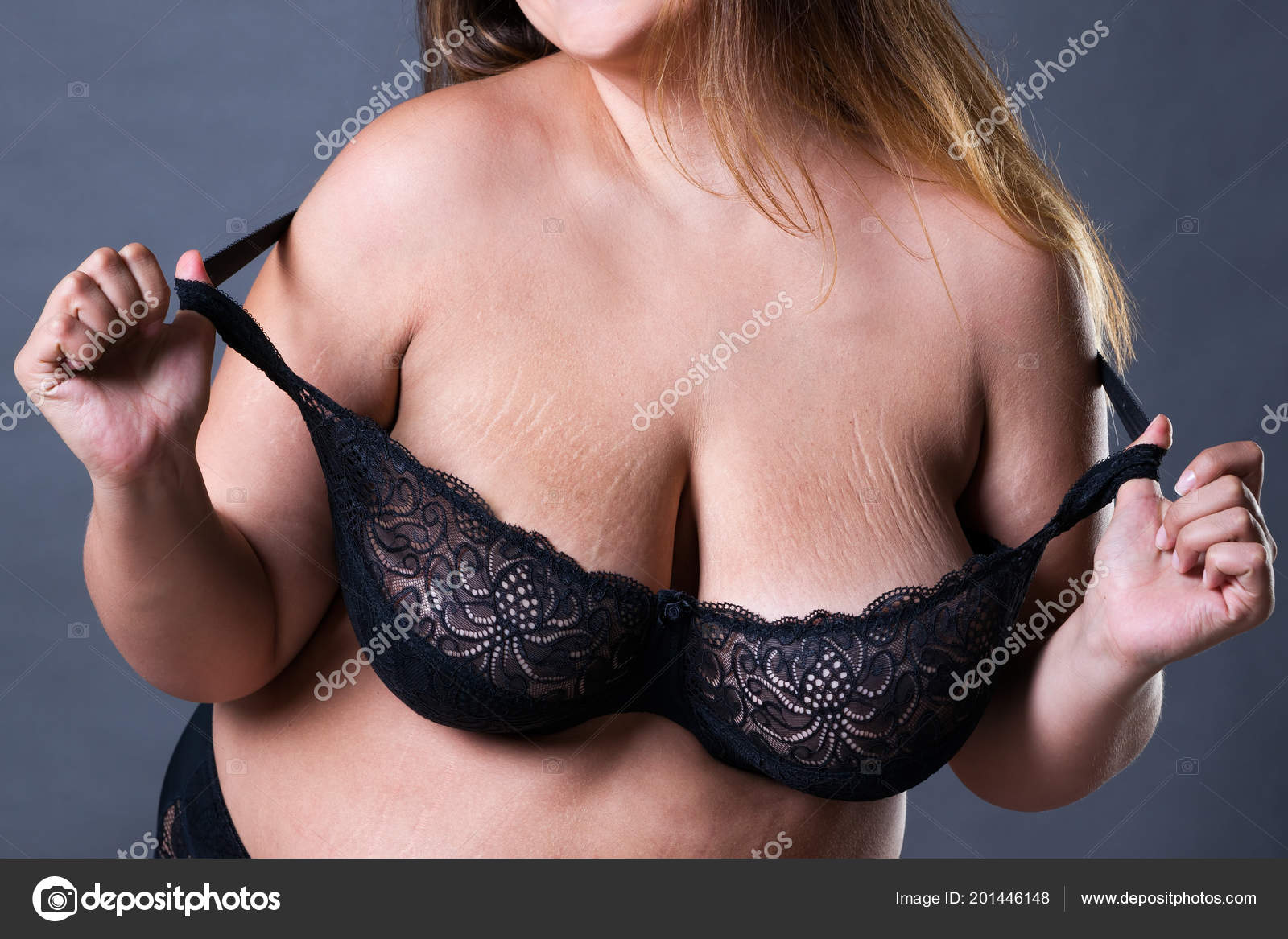 Stretch Marks Large Natural Breasts Obese Woman Big Boobs Overweight Stock Photo starast 201446148