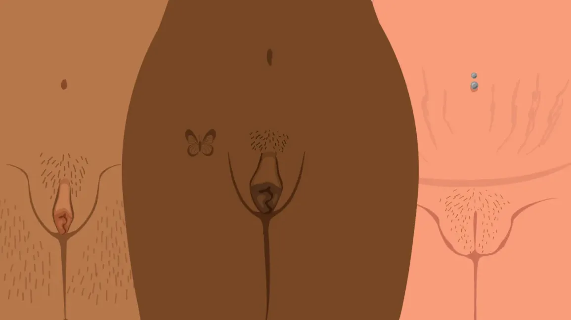Lopsided Vagina: 9 Different Labia Shapes Colors and Sizes