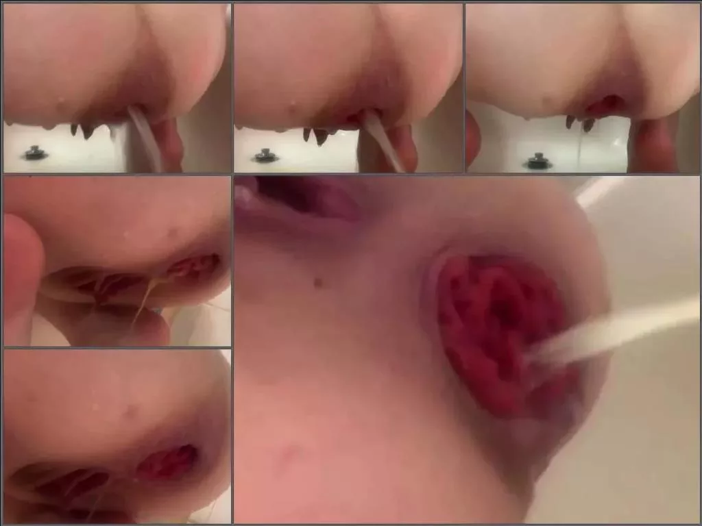 Natural Anal Gape