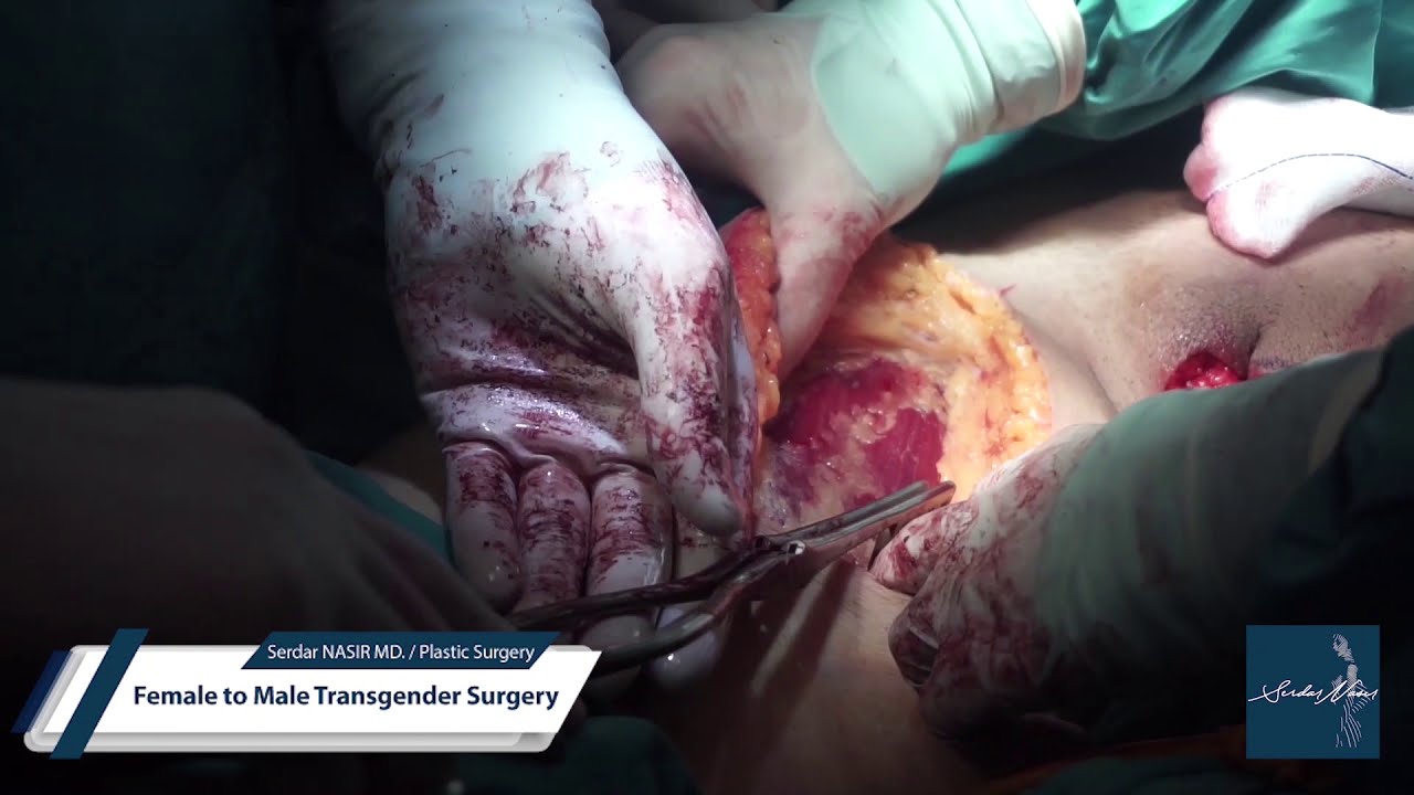Serdar Nasr MD. Plastic Surgery