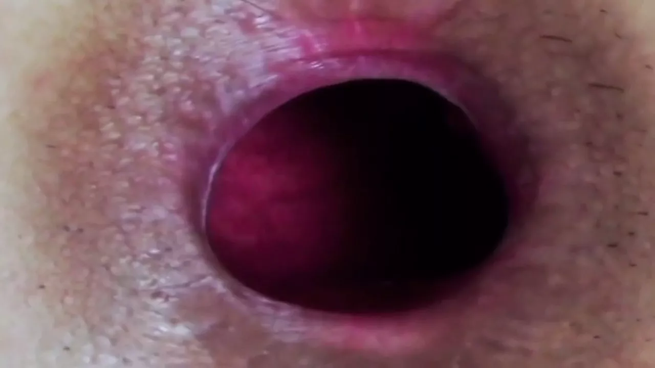 Extreme Closeup Gaping Hollow Asshole: Homemade Porn