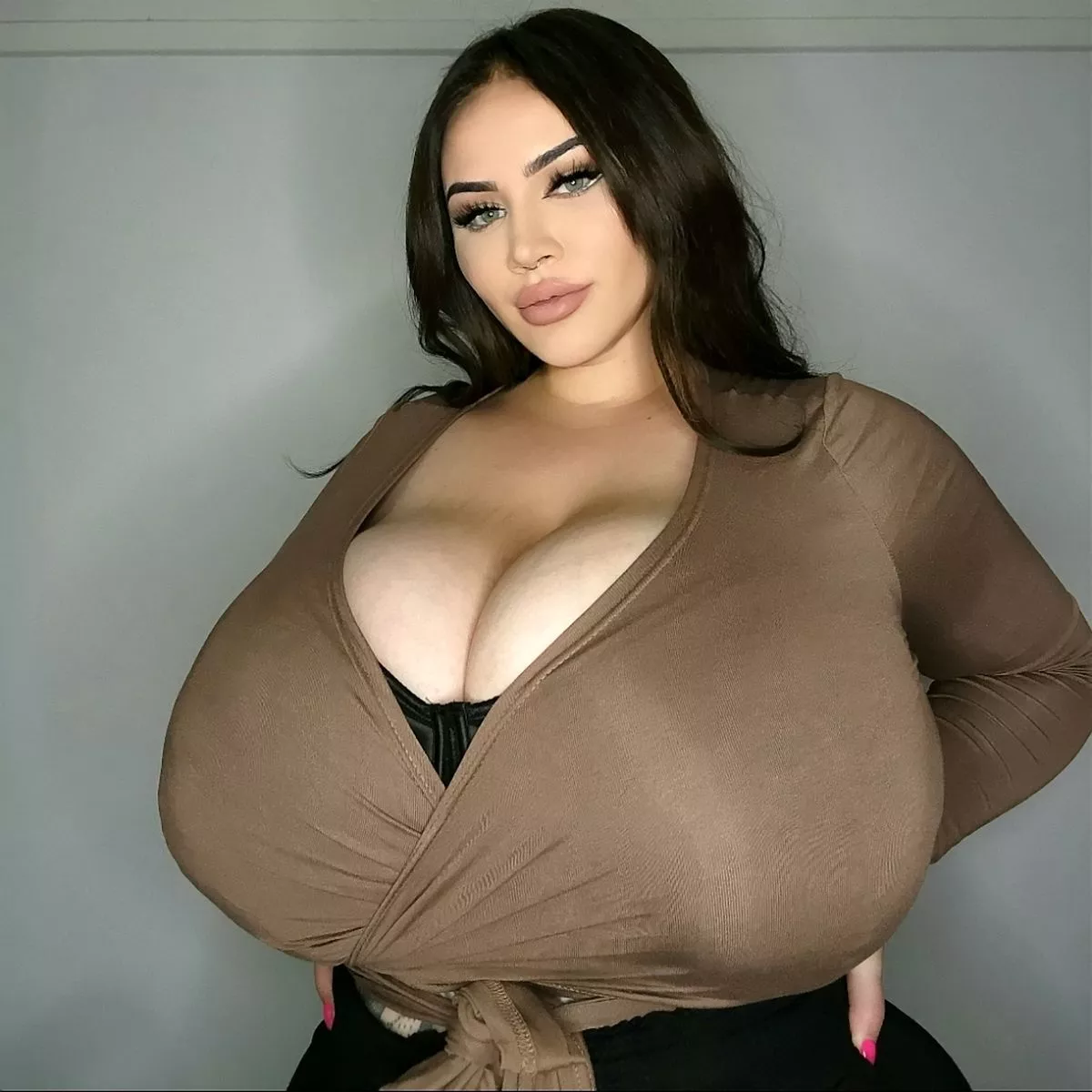 My P-cup boobs wont stop growing due to ultra rare condition