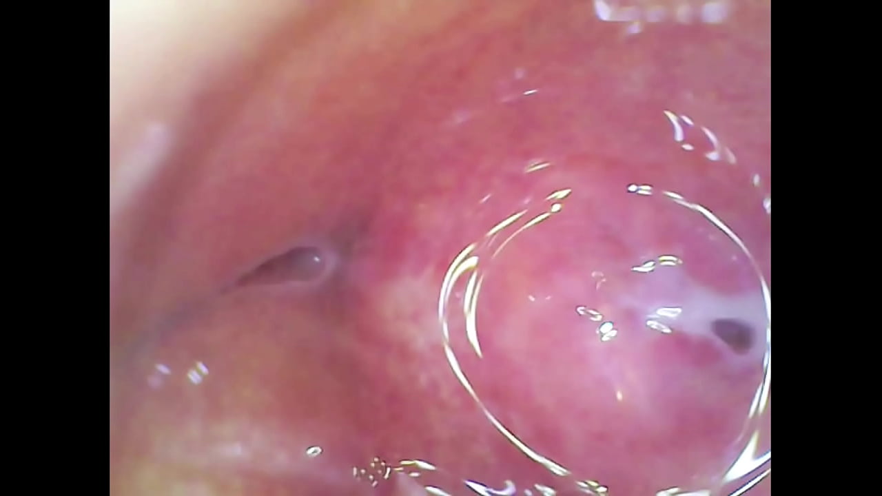 Real pussy orgasm contraction cam inside pussy!!! Sperm found in pussy juice under microscope!!!