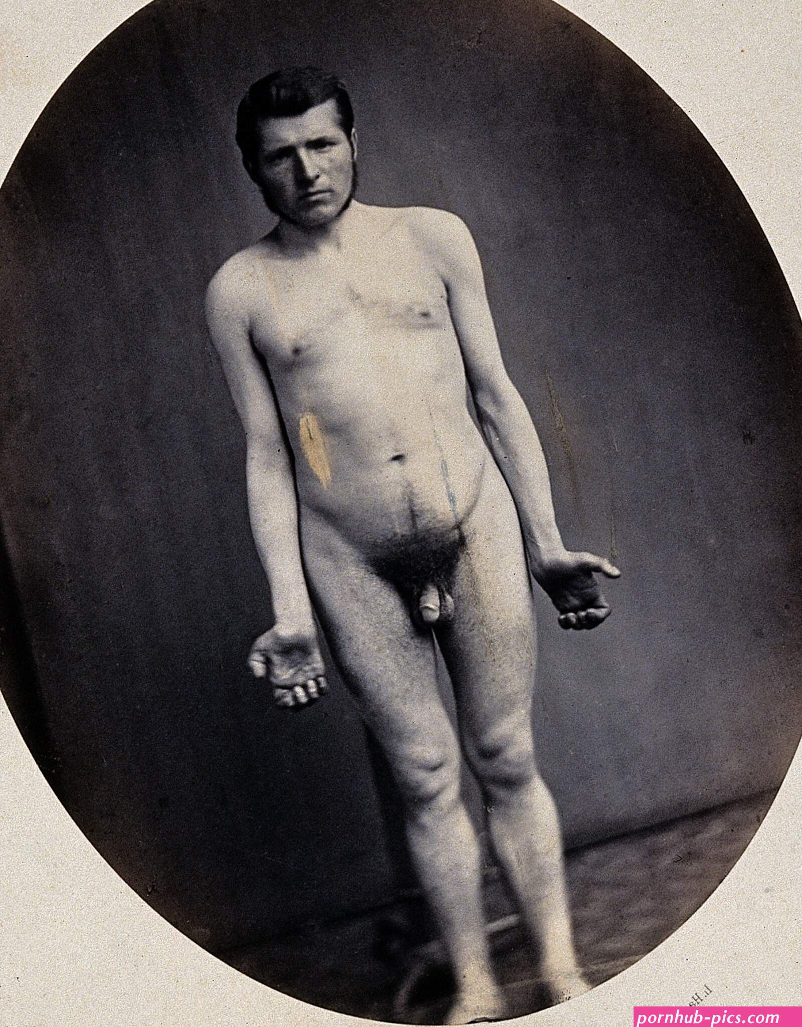File:A naked man viewed from the front in full-length with semi- Wellcome V0029438.jpg