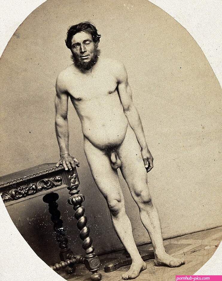 File:A naked man standing viewed in full length from the front Wellcome V0029505.jpg