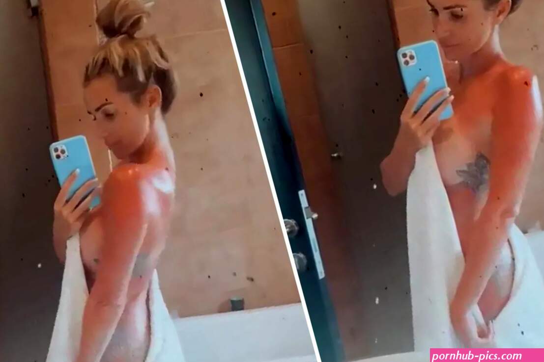 Love Islands Laura Anderson strips naked to show off sunburn after moving to Dubai