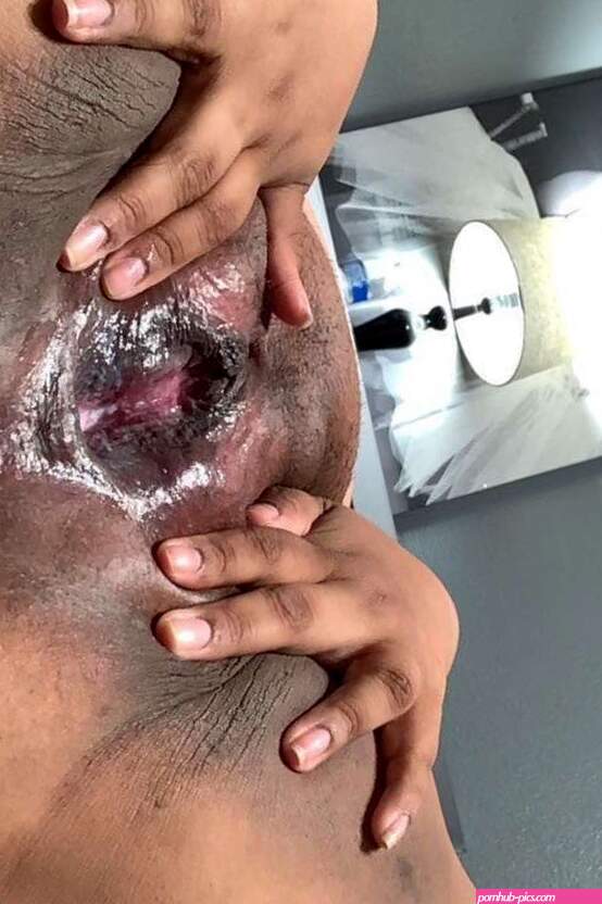 More of my dark fat pussy but pink in the inside of my fat dark...