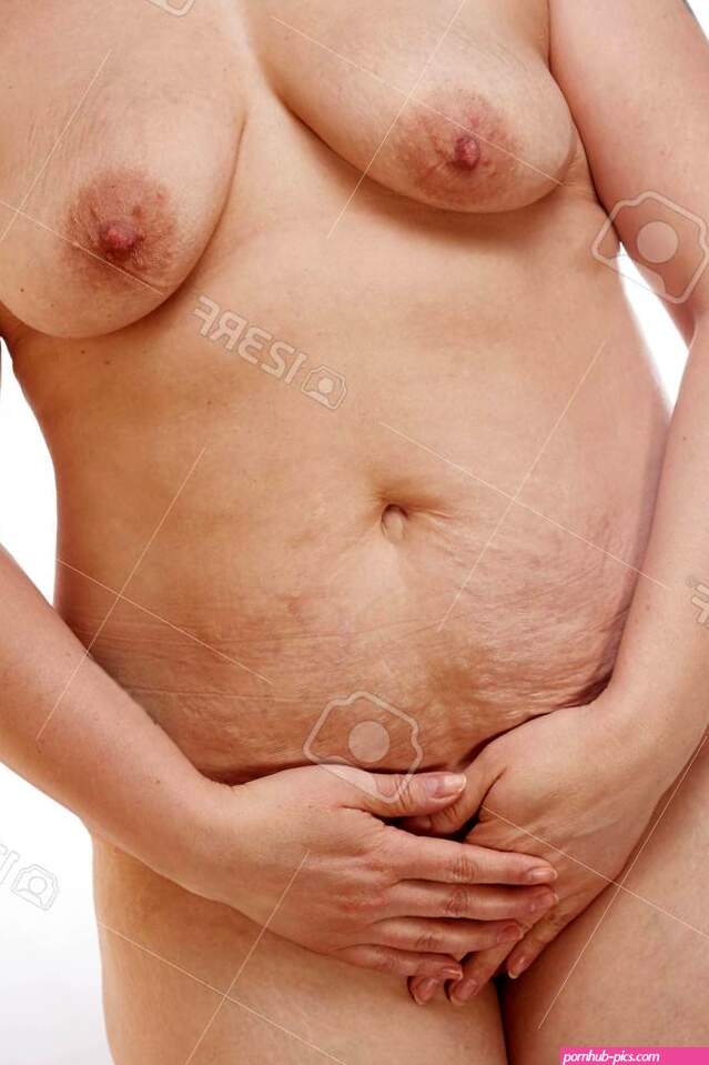 Naked 40-year-old Woman With Sagging Breasts Overweight Stretch Marks And Cellulite On A White Isolated Background. Concept For Medicine And Cosmetology Stock Photo Picture and Royalty Free Image. Image 146104213.