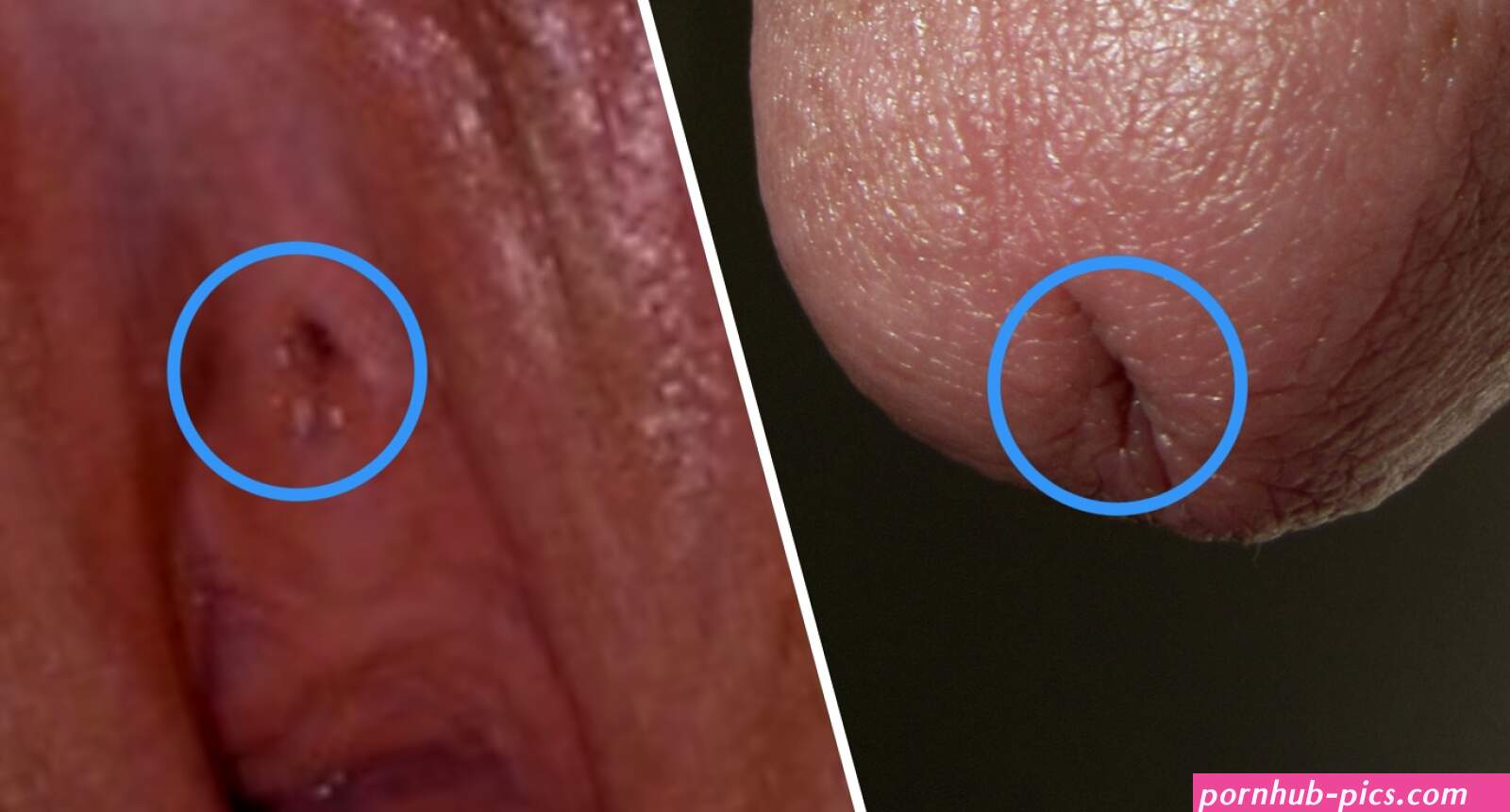 Urinary meatus