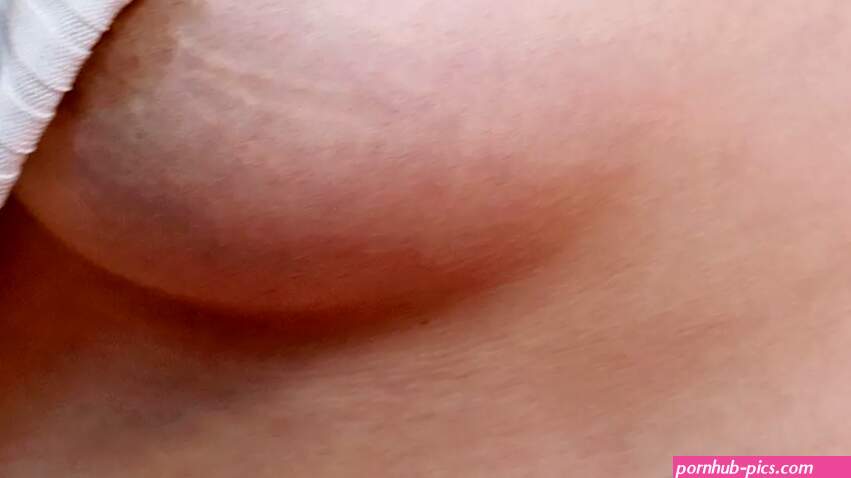 How I Learned to Love My Stretch Marks