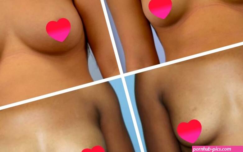 Natural breast augmentation by Beverly Hills Female Plastic Surgeon Dr. Cat Begovic